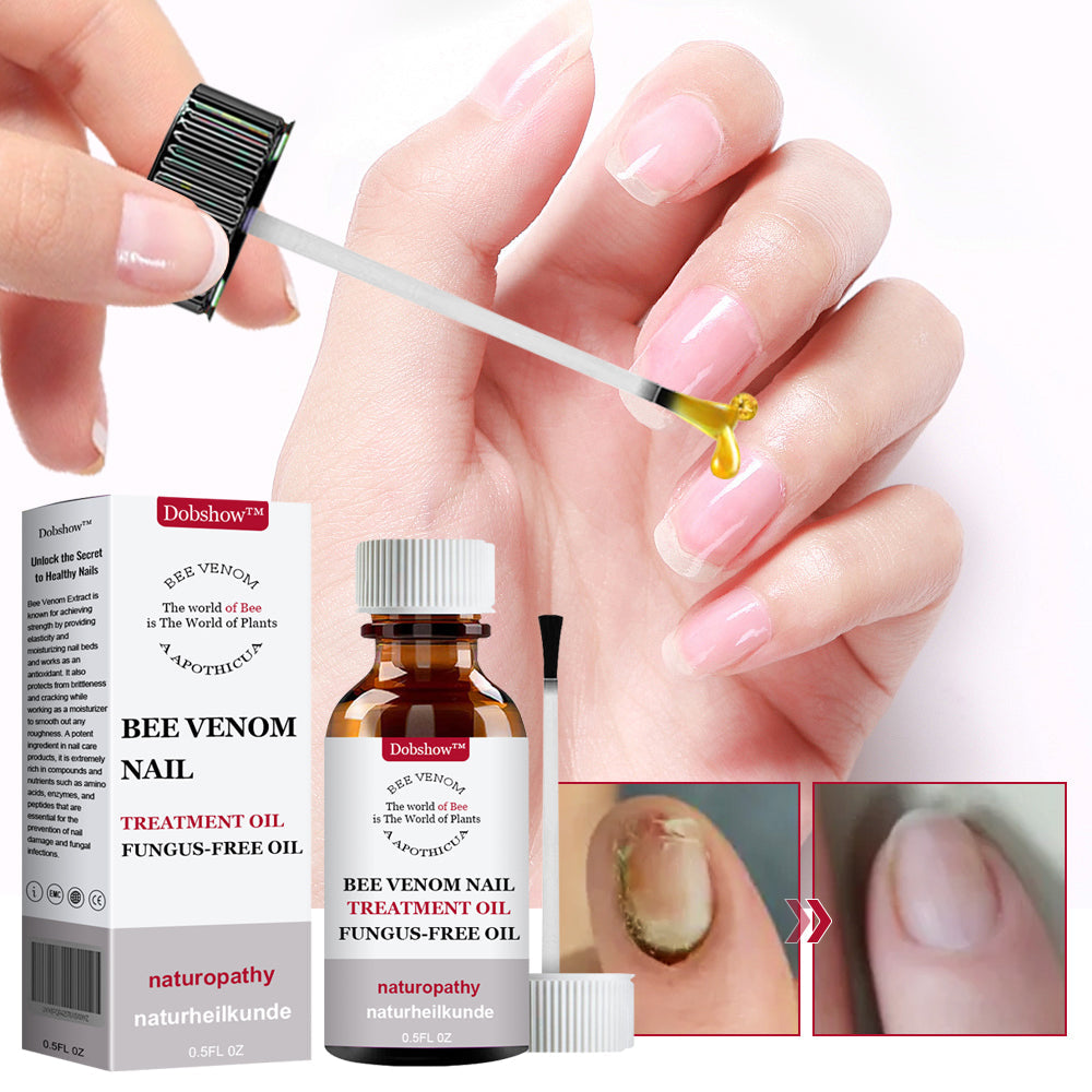 🐝Dobshow™ Fungus-Free Bee Venom Nail Treatment Serum🐝