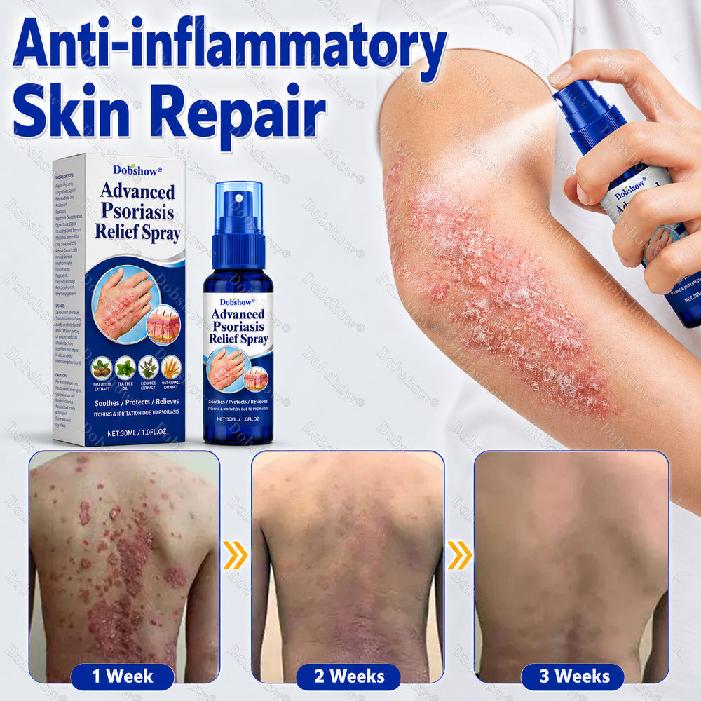 Dobshow® Advanced Psoriasis Relief Spray -Z