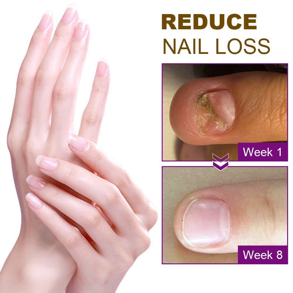 🐝Dobshow™ Fungus-Free Bee Venom Nail Treatment Serum🐝