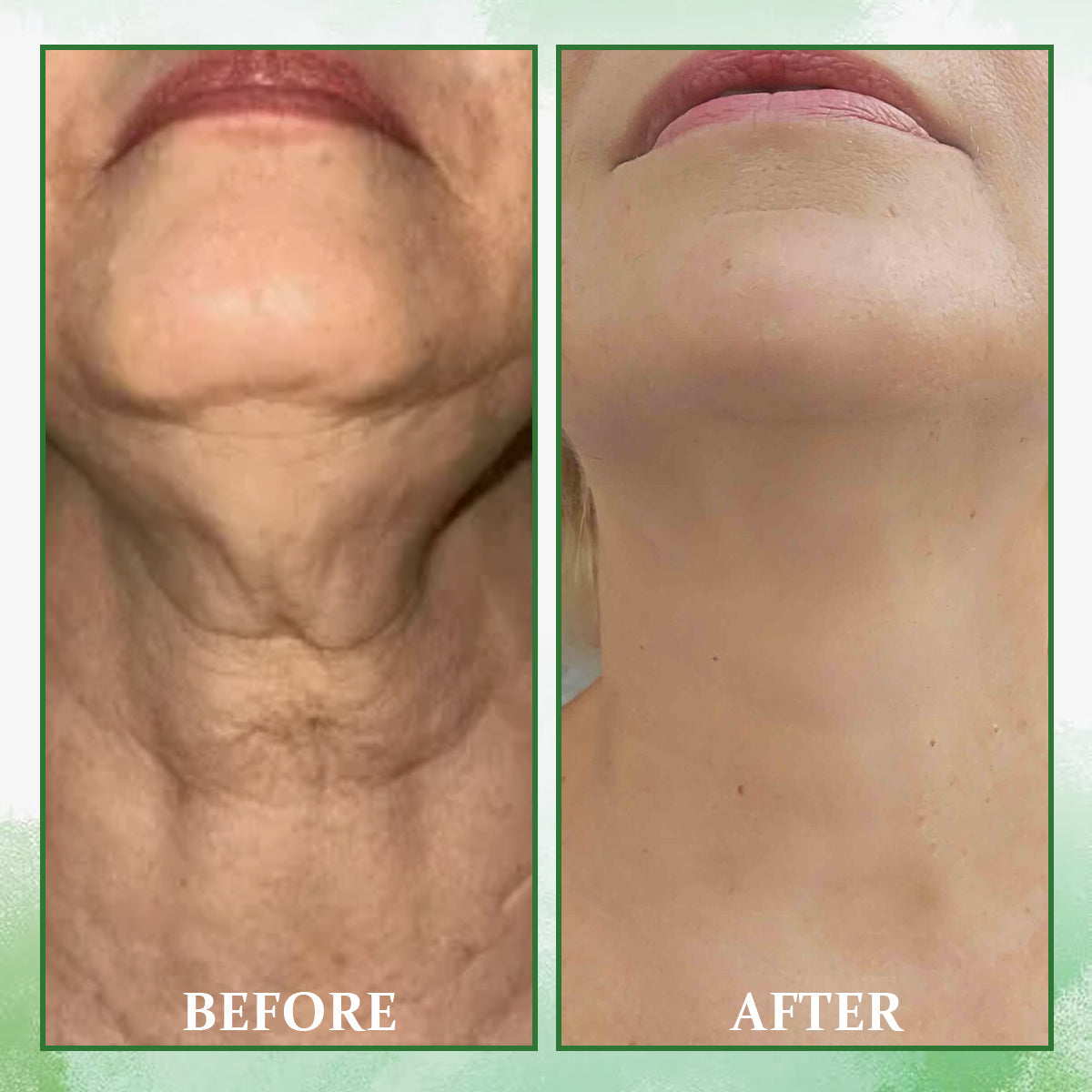 Fubsta™ Advanced  Peptide Firming & Wrinkle-Reducing Cream