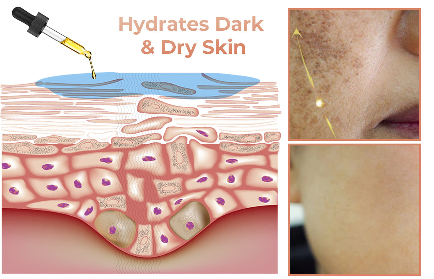 ✨Fast Dark Spot Remover-Dobshow™ Melanin Correcting Facial Serum