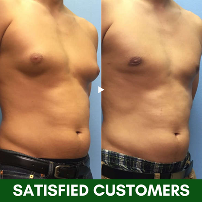 Dobshow™ TurmericMax Gynecomastia Compress Patch