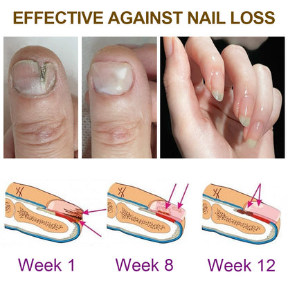 🐝Dobshow™ Fungus-Free Bee Venom Nail Treatment Serum🐝