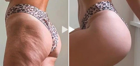 Nurbini™ Lifting Oil For Butt & Breast - Natural & Plumping 🍑 🎀 👙