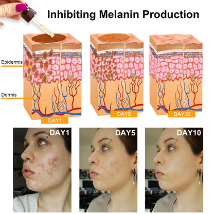 ✨Fast Dark Spot Remover-Dobshow™ Melanin Correcting Facial Serum