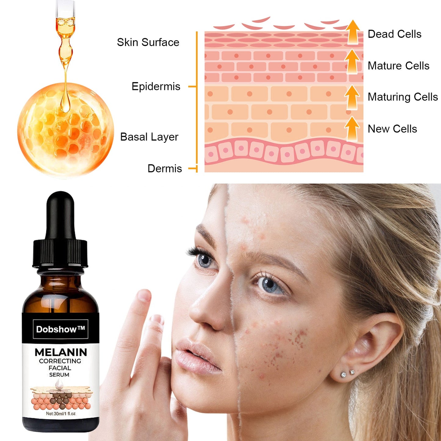 ✨Fast Dark Spot Remover-Dobshow™ Melanin Correcting Facial Serum