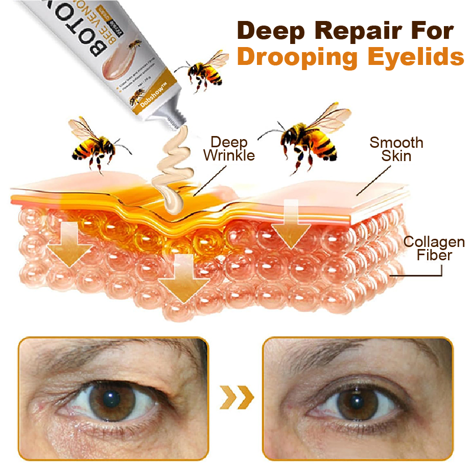 🐝🐝Dobshow™ Botox Bee Venom Anti-wrinkle Cream 🐝🐝