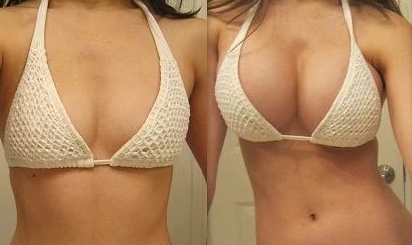 Nurbini™ Lifting Oil For Butt & Breast - Natural & Plumping 🍑 🎀 👙