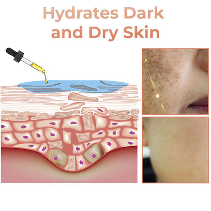 ✨Fast Dark Spot Remover-Dobshow™ Melanin Correcting Facial Serum