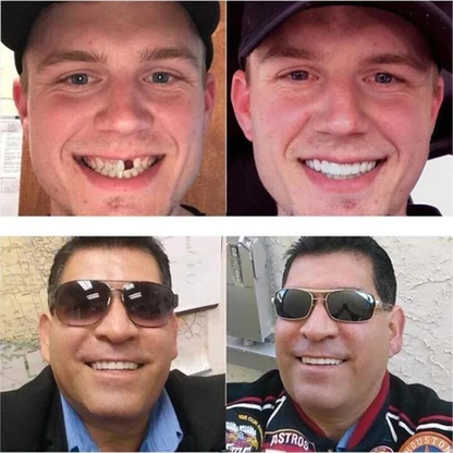 Nurbini™ Adjustable Snap Prosthesis 👍 Recommended by professionals,environmentally friendly