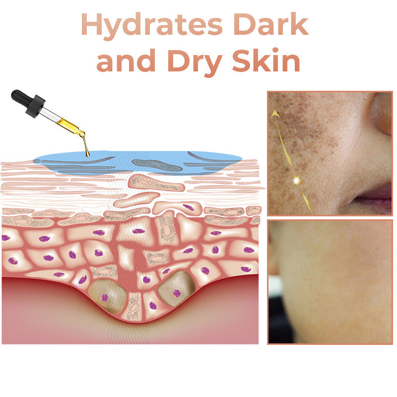 ✨Fast Dark Spot Remover-Dobshow™ Melanin Correcting Facial Serum