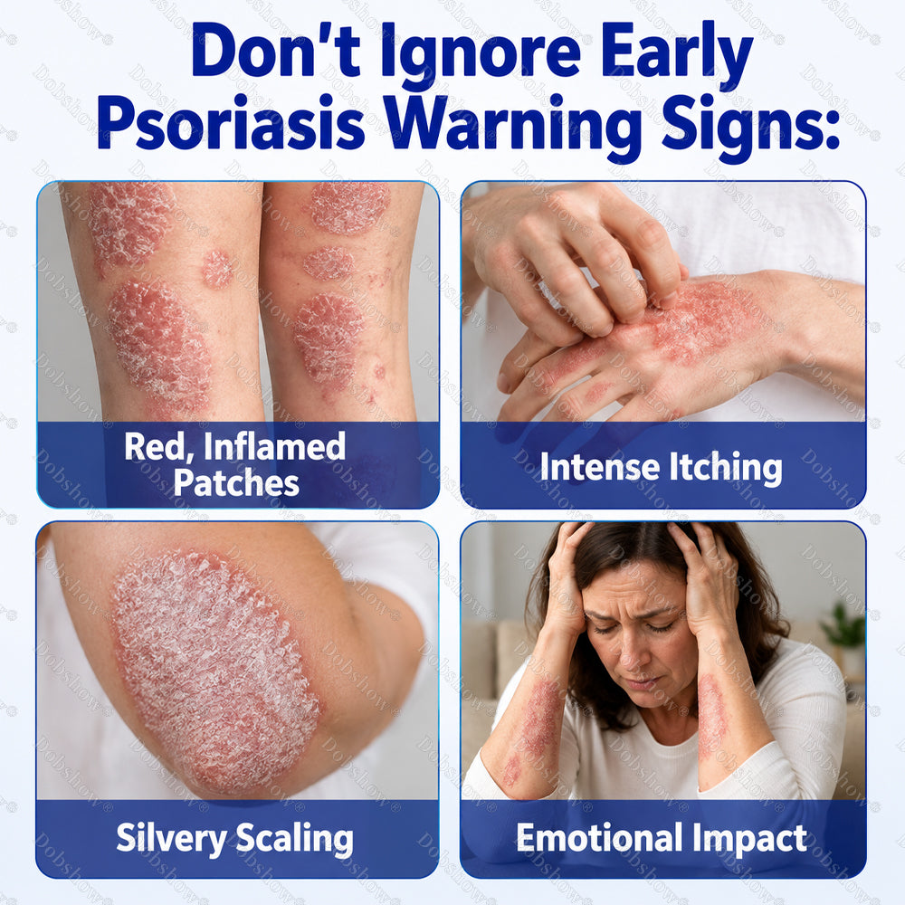 Dobshow® Advanced Psoriasis Relief Spray -Z