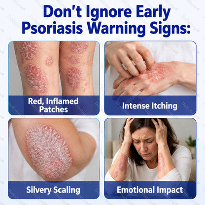 Dobshow® Advanced Psoriasis Relief Spray -Z