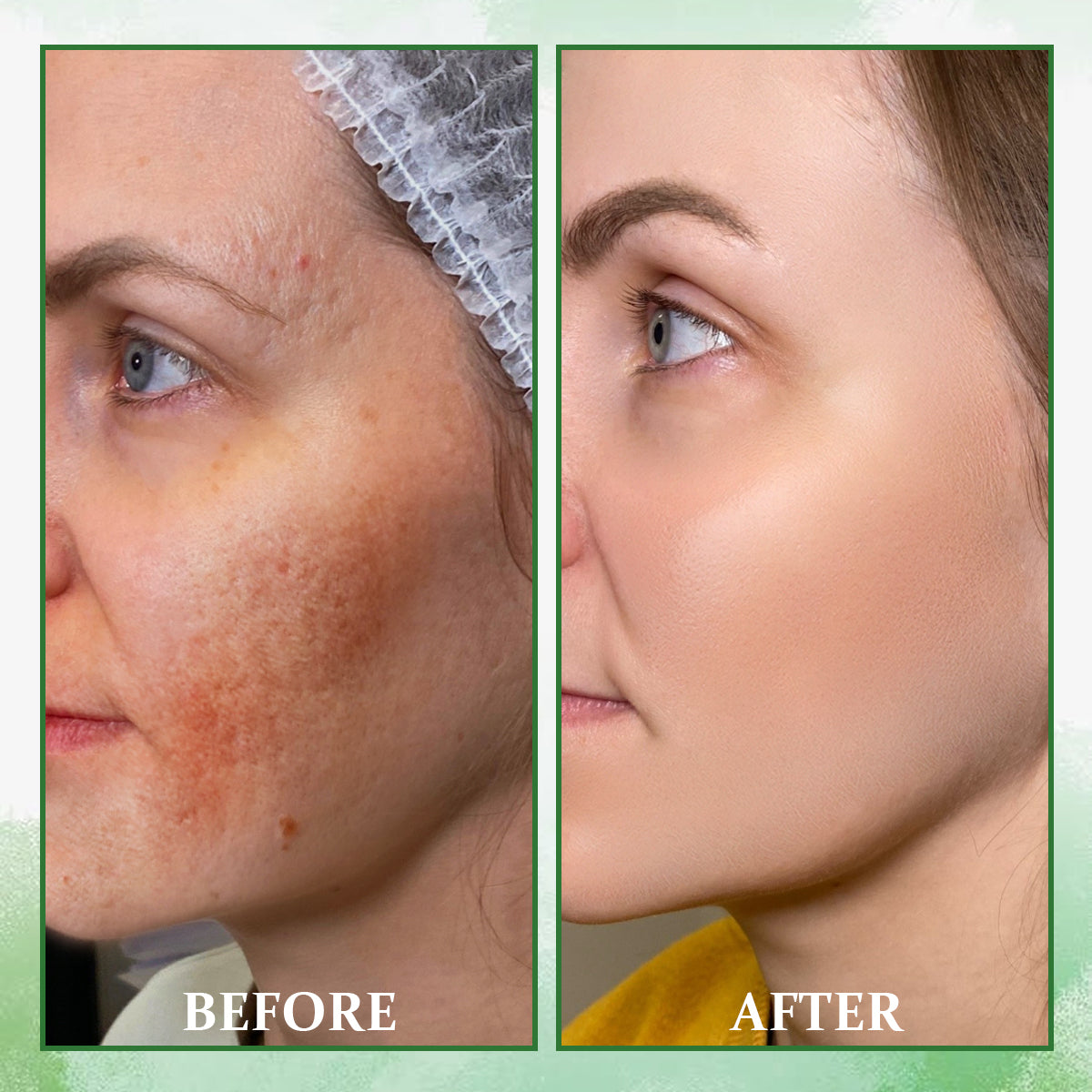 Fubsta™ Advanced  Peptide Firming & Wrinkle-Reducing Cream